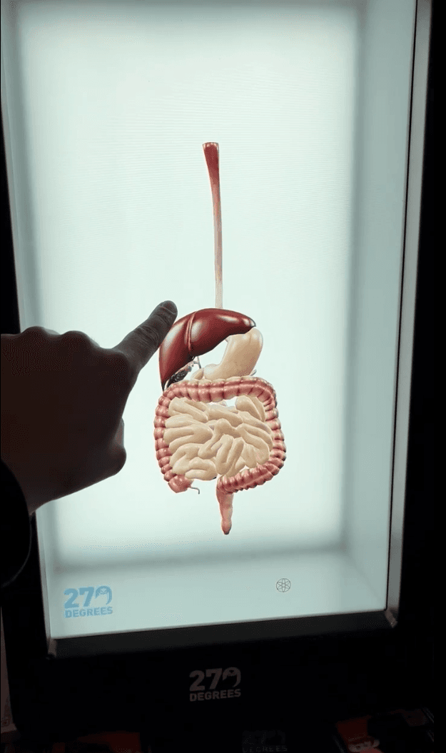 Een holografische medische visualisatie voor patiëntuitleg.